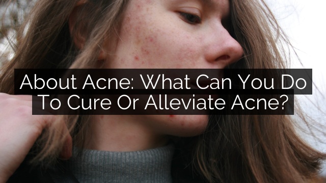 About Acne: What Can You Do To Cure Or Alleviate Acne?